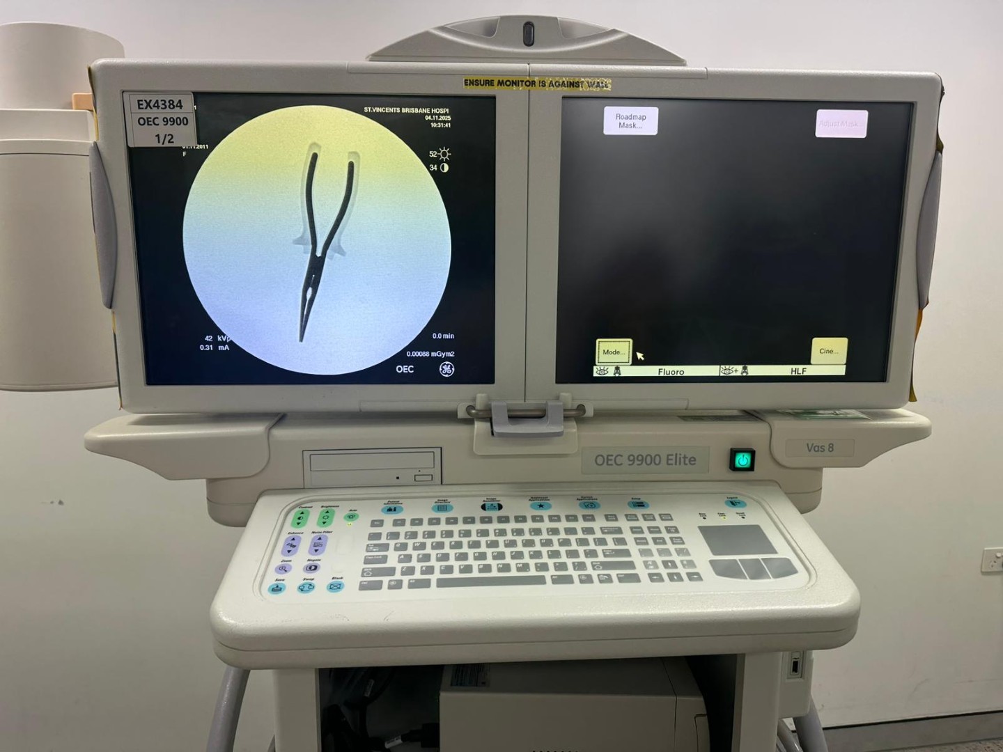 OEC 9900 Elite VAS 8 C-Arm Image
