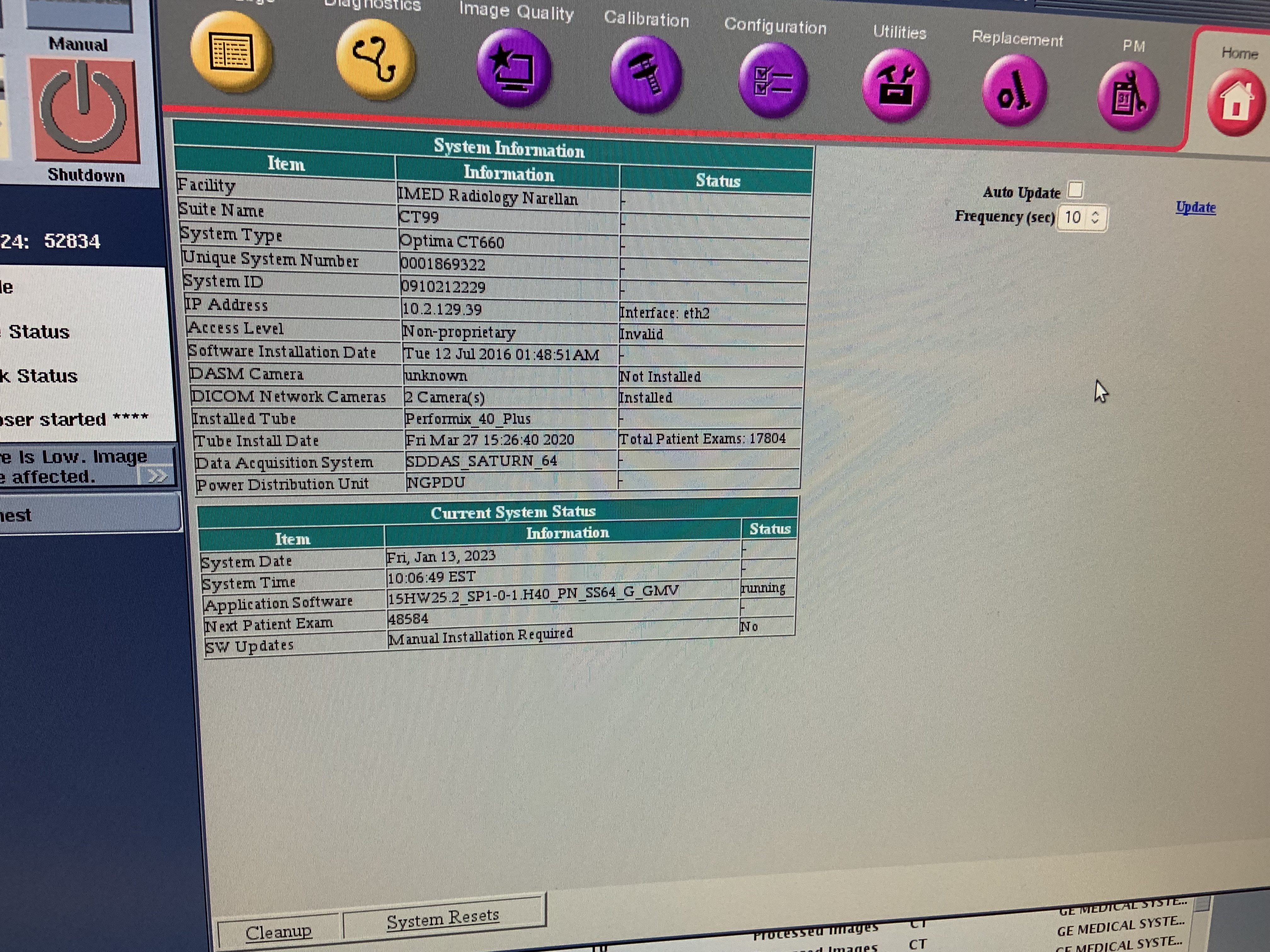 GE Optima 600 128 Slice CT Image