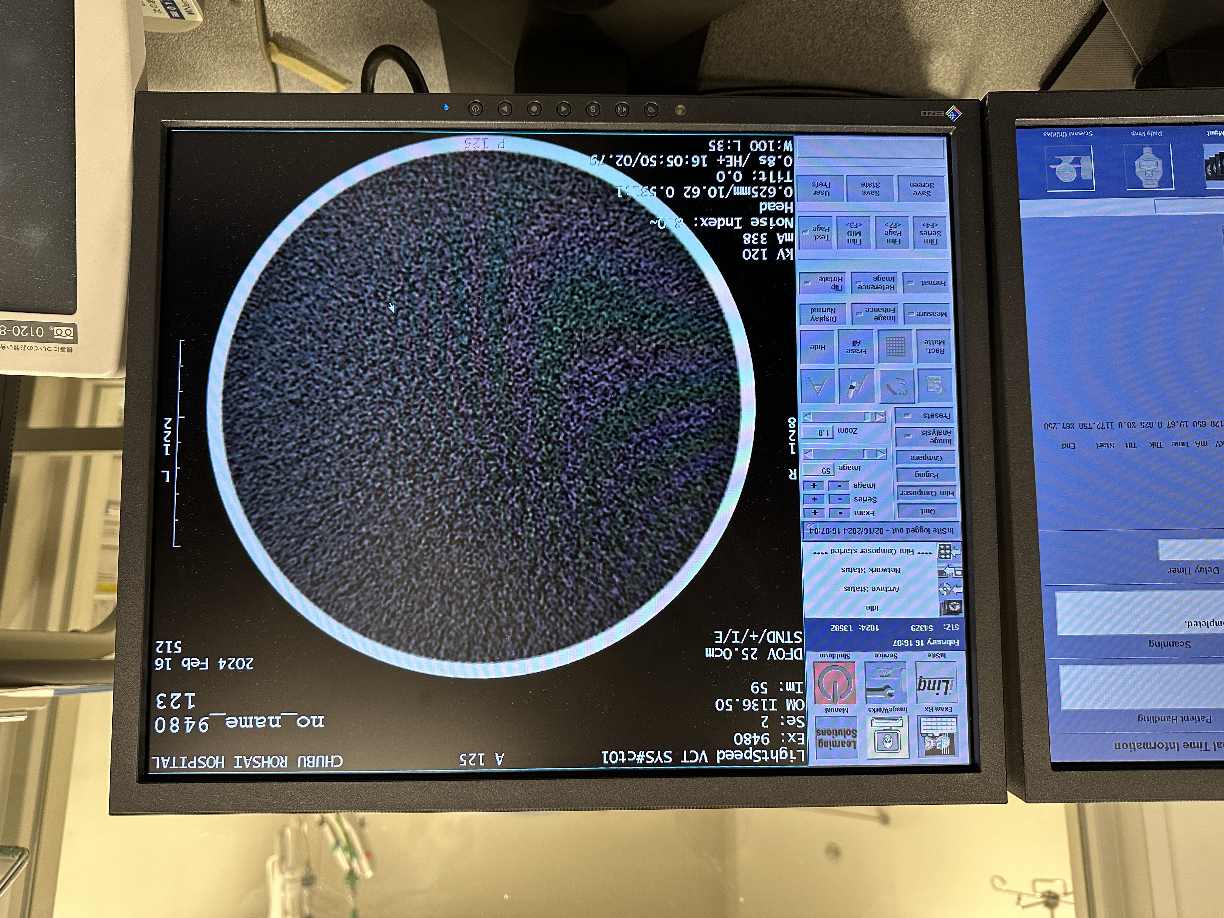 GE Lightspeed VCT 64 slice Image