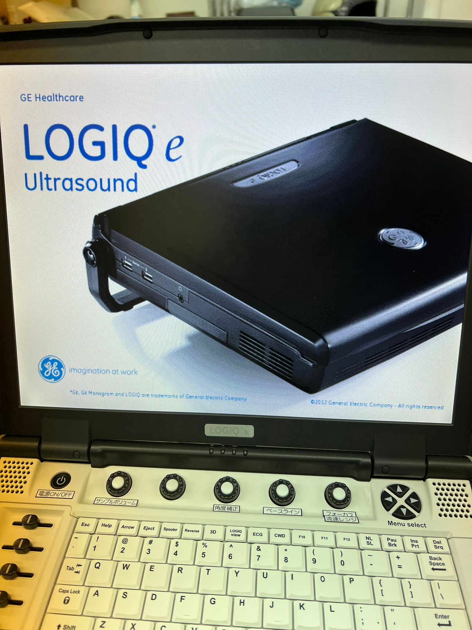 GE Logiq e Portable Ultrasound Image