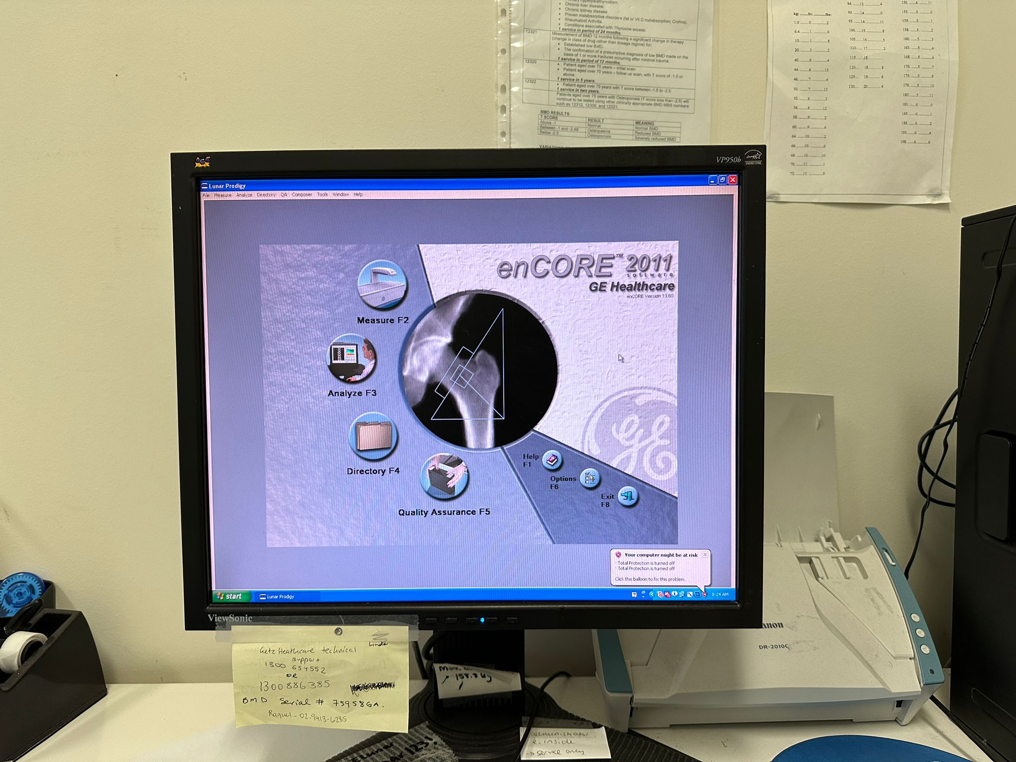 GE Lunar Prodigy Bone Densitometer Image