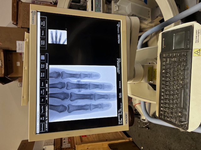 Hologic Fluoroscan InSight FD Mini C-Arm Image