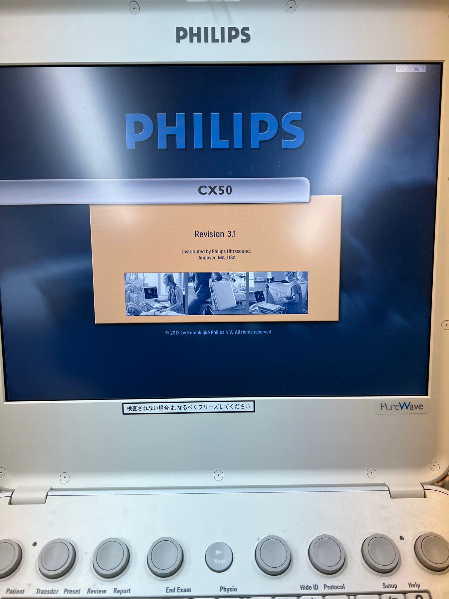 Philips CX50 Portable Ultrasound Image