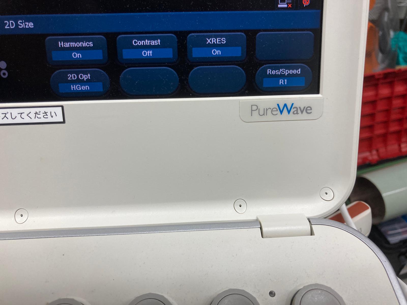 Philips CX50 Portable Ultrasound Image