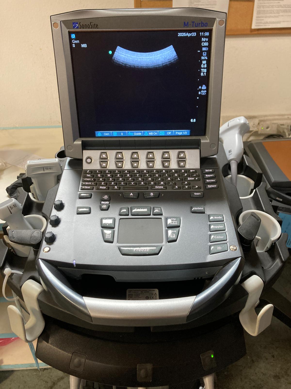 Sonosite M-Turbo Portable Ultrasound Image