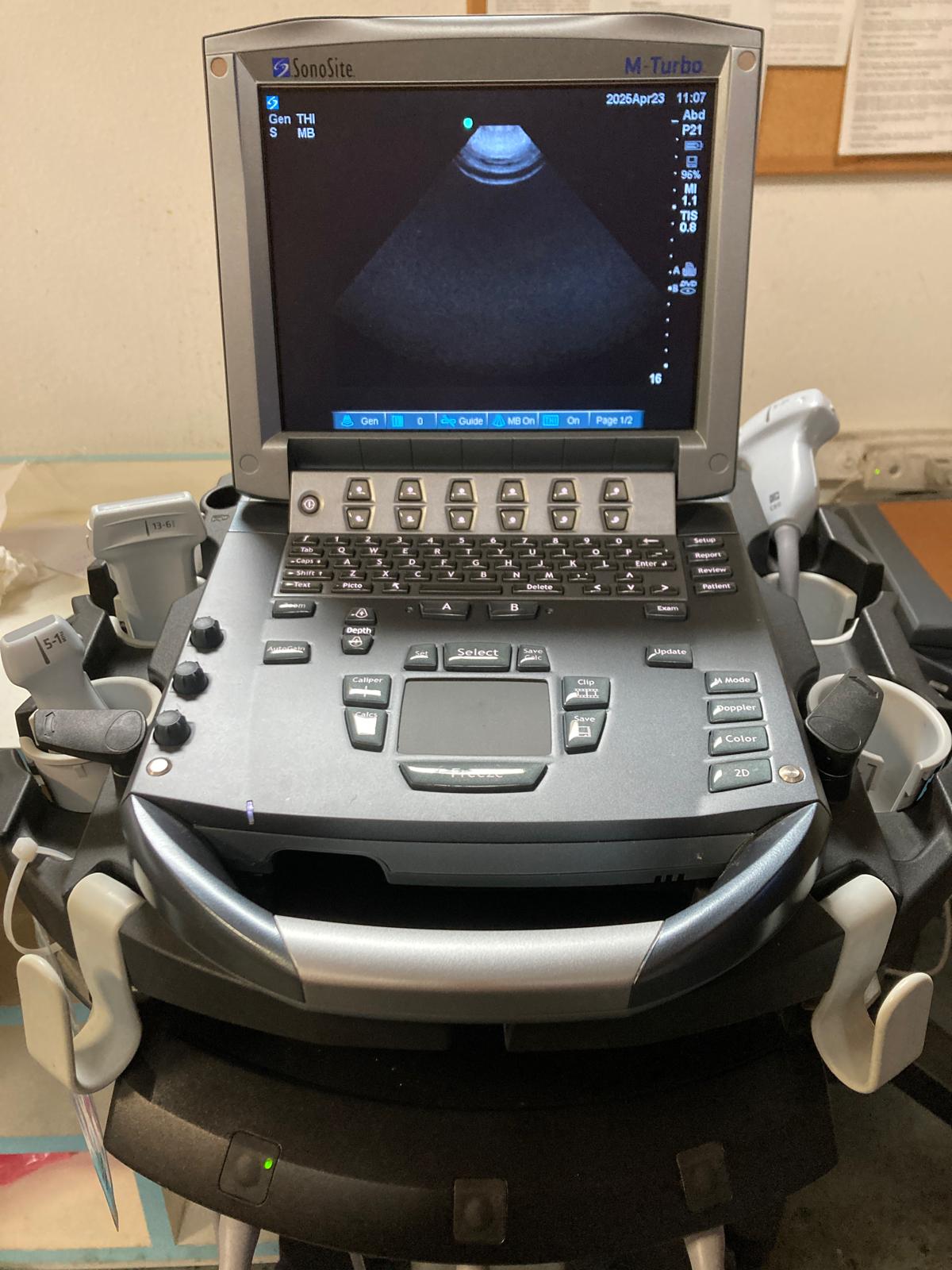 Sonosite M-Turbo Portable Ultrasound Image