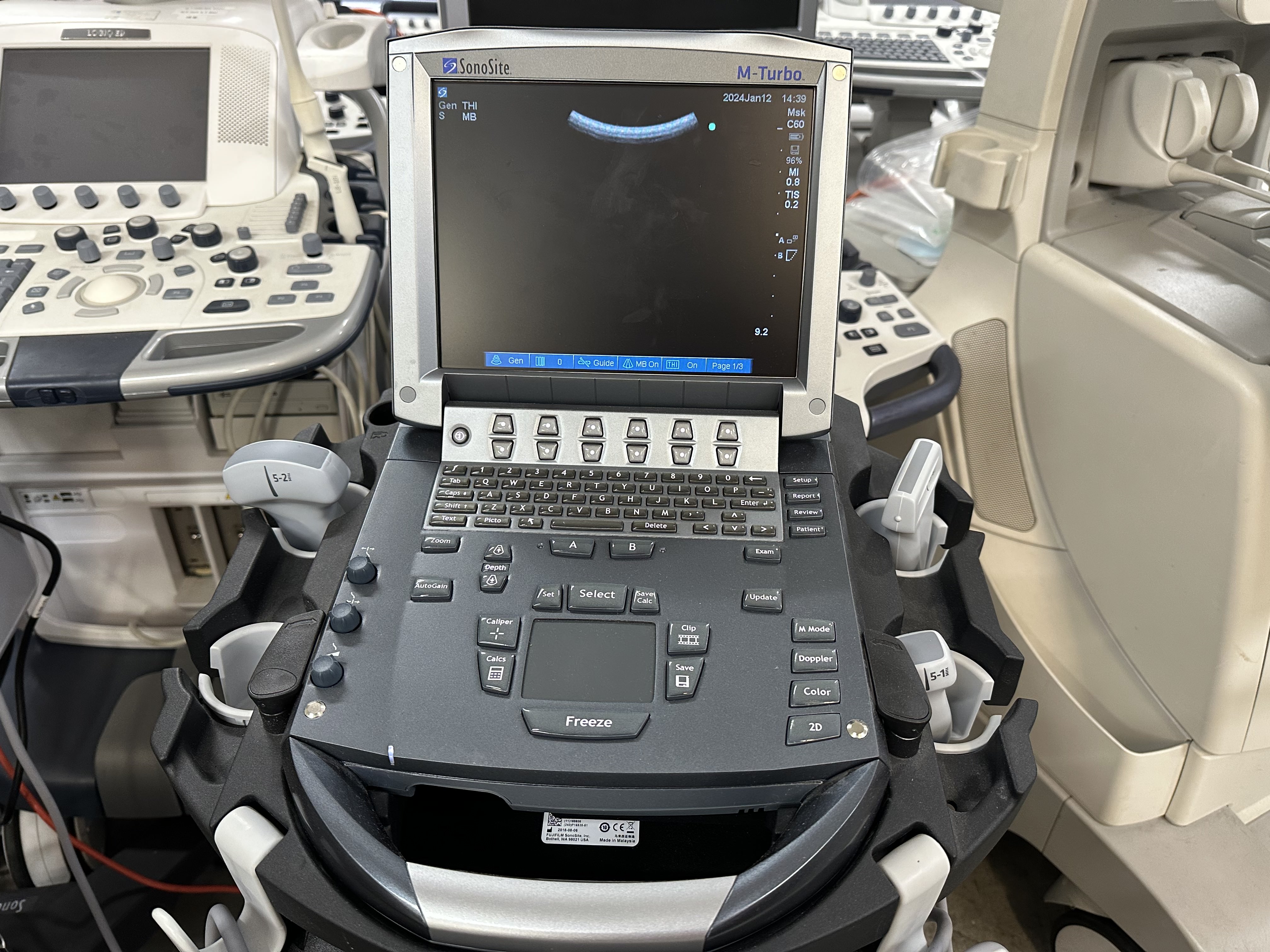 Sonosite M-Turbo Portable Ultrasound Image